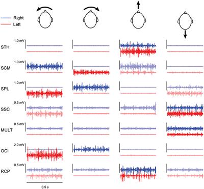 Electrical Vestibular Stimuli Evoke Robust Muscle Activity in Deep and Superficial Neck Muscles in Humans